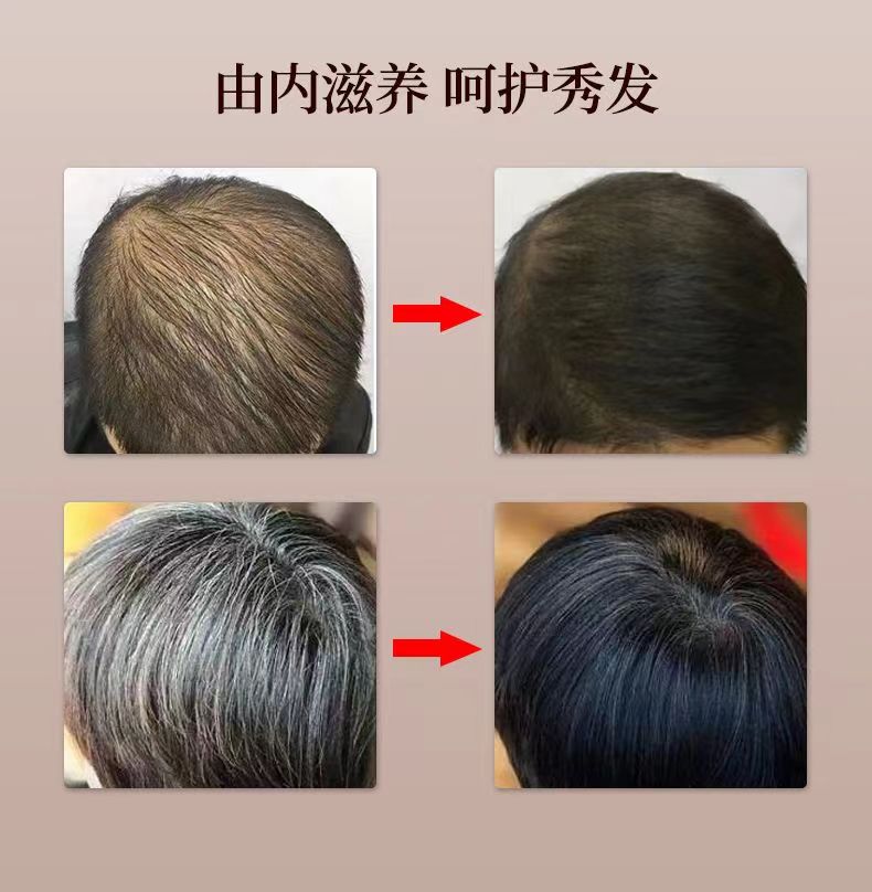 本卡密丁8.jpg